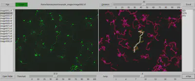 Automatically measure the length of axons with a single mouse click.